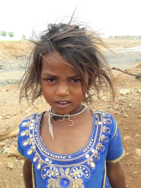 World Vision India